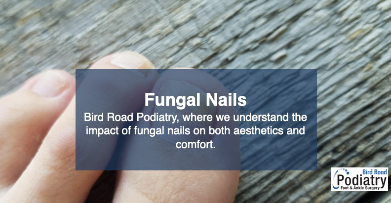 Fungal Nails