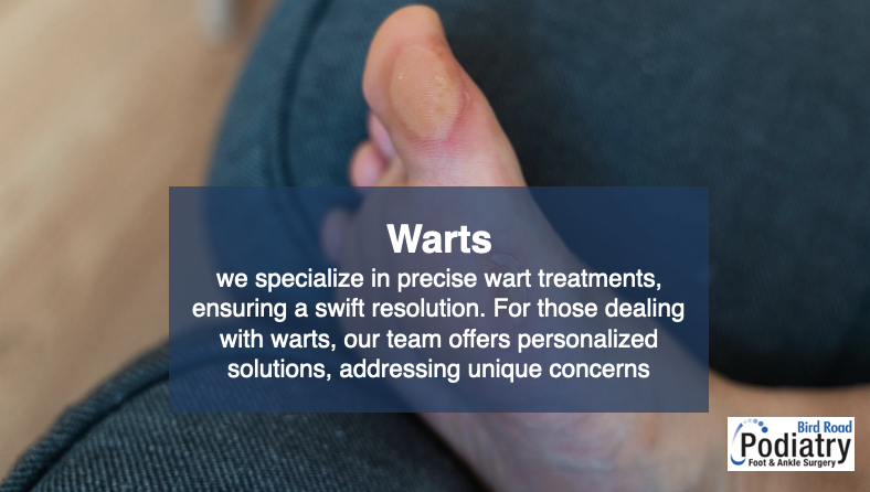 Warts